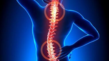 mekanizmi i zhvillimit të osteokondrozës