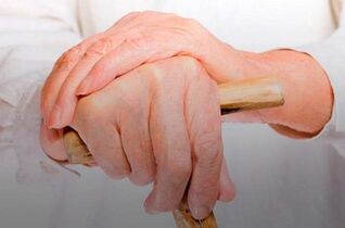 dhimbje në nyjet e gishtave me artrit reumatoid