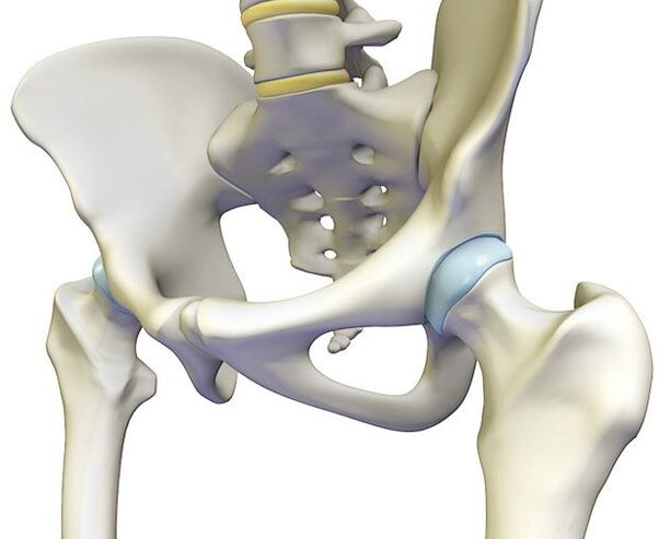 Osteokondroza provokon një dhimbje të mprehtë në nyjen e hipit