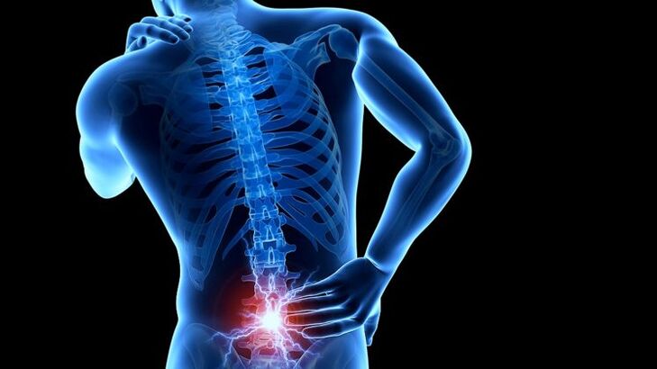 dhimbje shpine me osteokondrozë lumbare